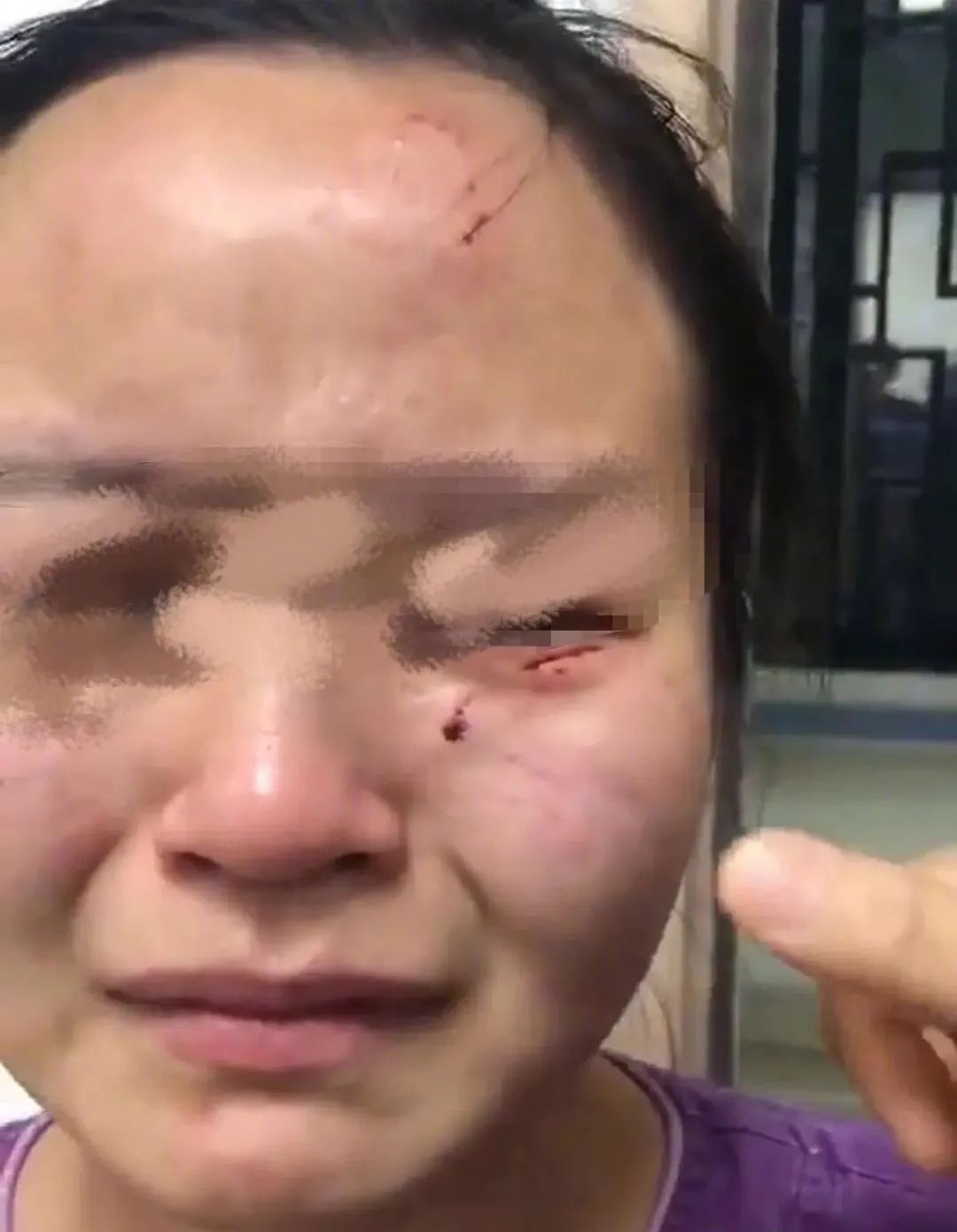 男子持水杯砸伤女同事被刑拘后续关于男子持水杯砸伤女同事被刑拘的后续报道